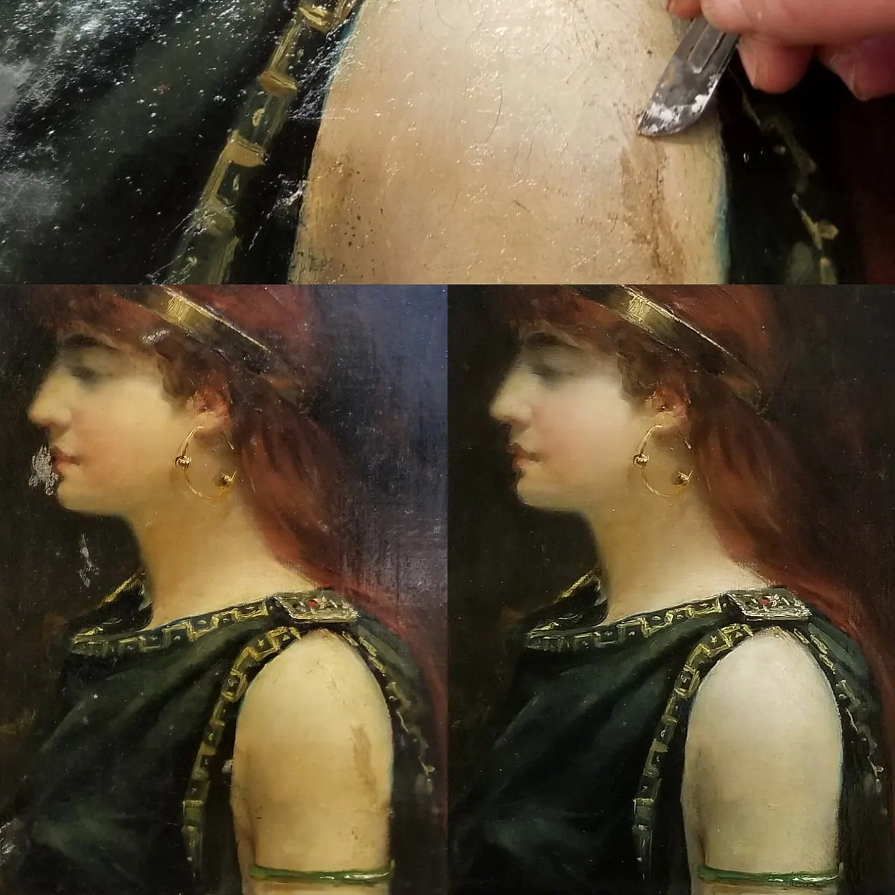 Réintégration des lacunes et retouche illusionniste — portrait de profil au grand anneau — Dépose au scalpel, puis avant / après retouche