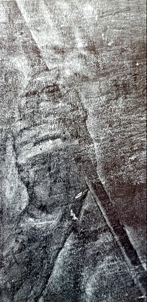 Radiographie de la main droite du Saint Sébastien tenant la flèche — examen aux rayons X